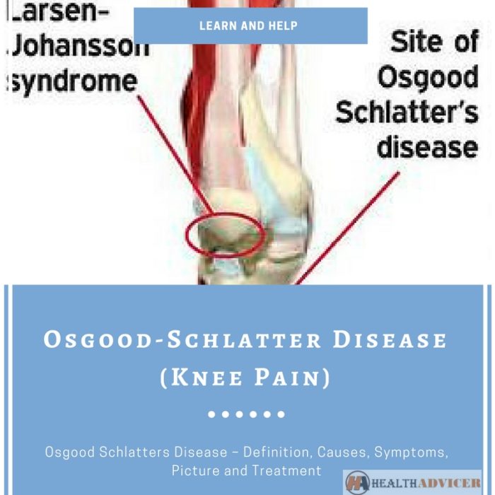 Osgood-Schlatter Disease (Knee Pain)
