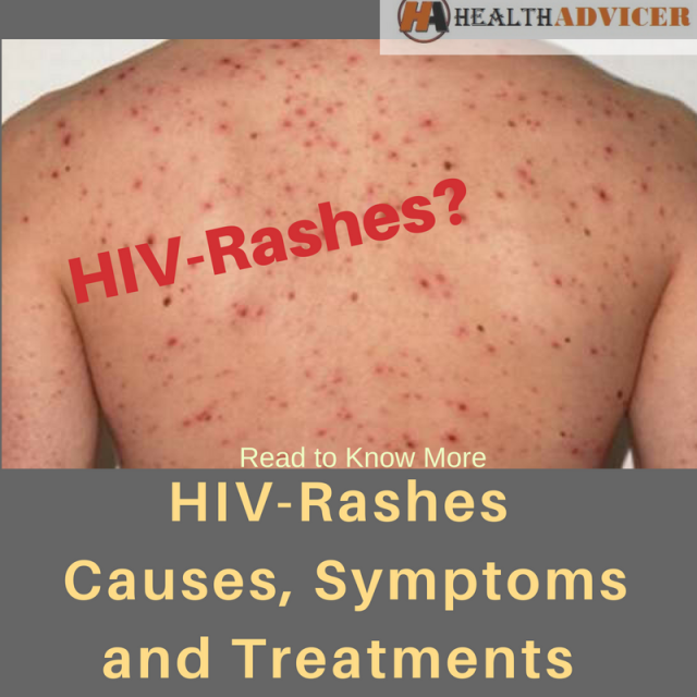 Health Advicer Health Article Blog Conditions and Diseases