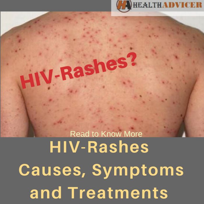 HIV Rashes