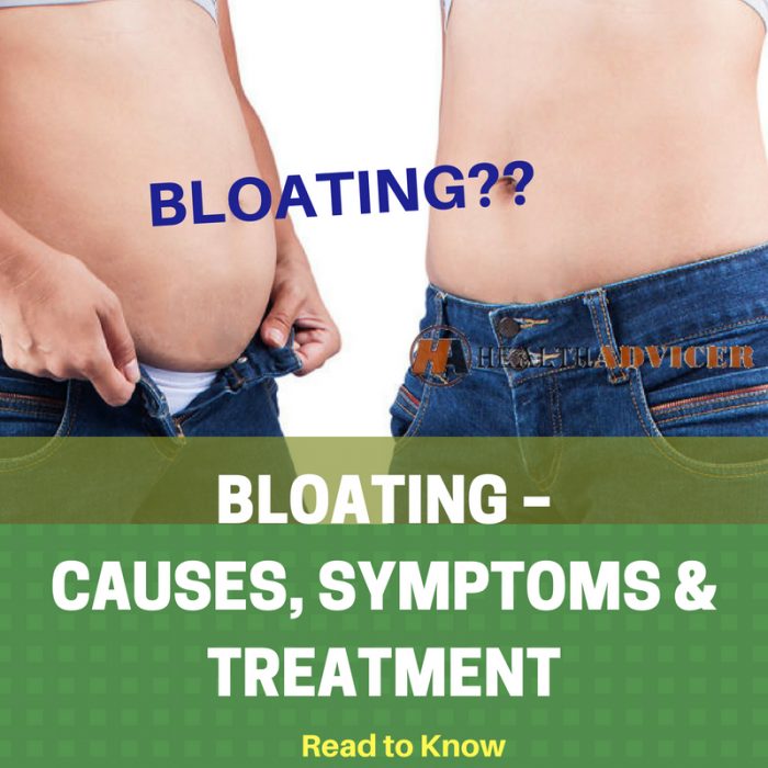 BLOATING