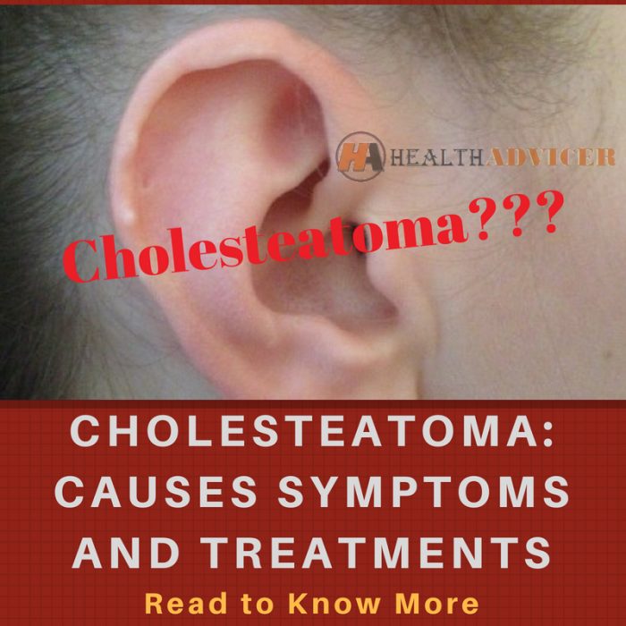 Cholesteatoma