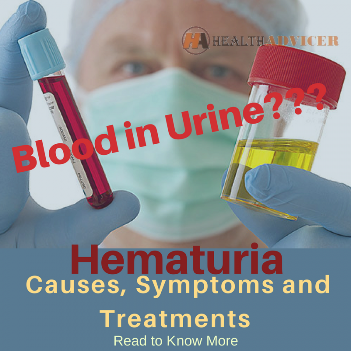 Blood In Urine: Definition, Causes, When to Contact a 