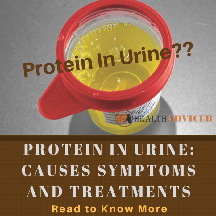 Protein In Urine Causes Picture Symptoms And Treatment