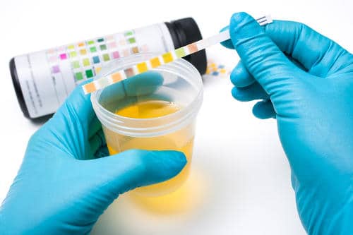 Urine Tests