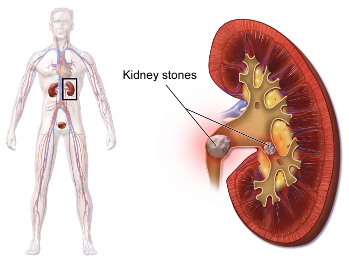 kidney