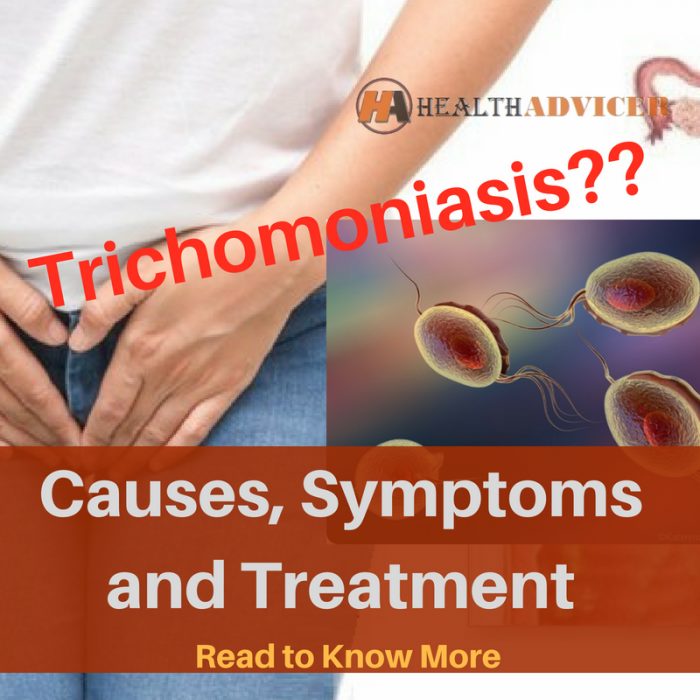 triconomiasis