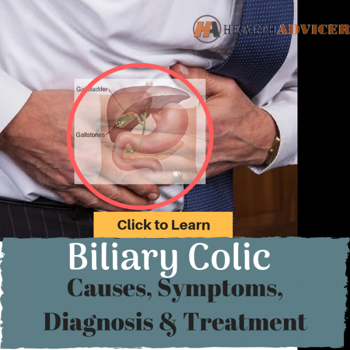 Biliary Colic