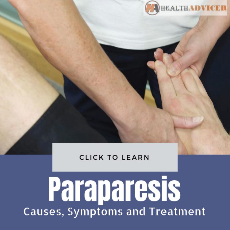 Paraparesis Causes Treatment