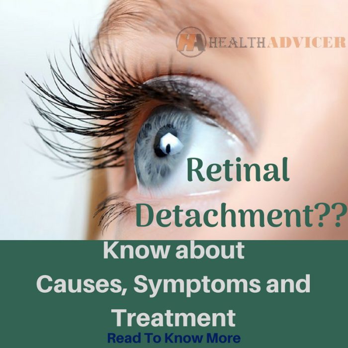 Retinal Detachment