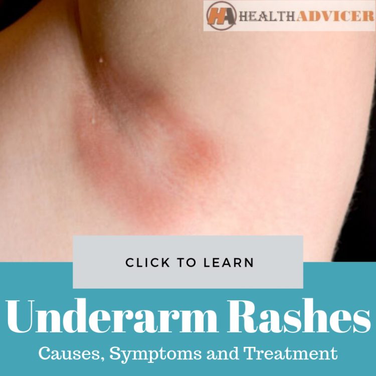 Underarm Rashes