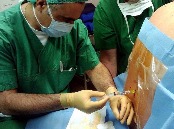 Spinal Cord Anesthesia