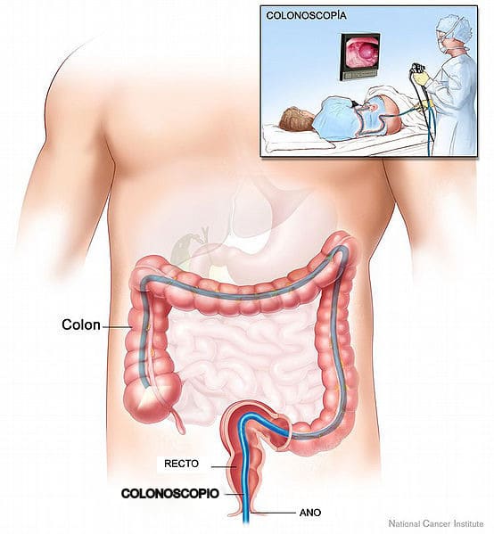 Imaging Tests