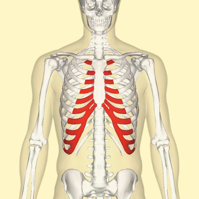 Costochondritis