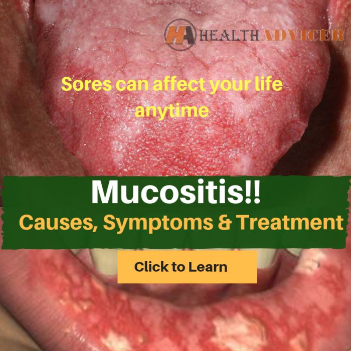 Mucositis
