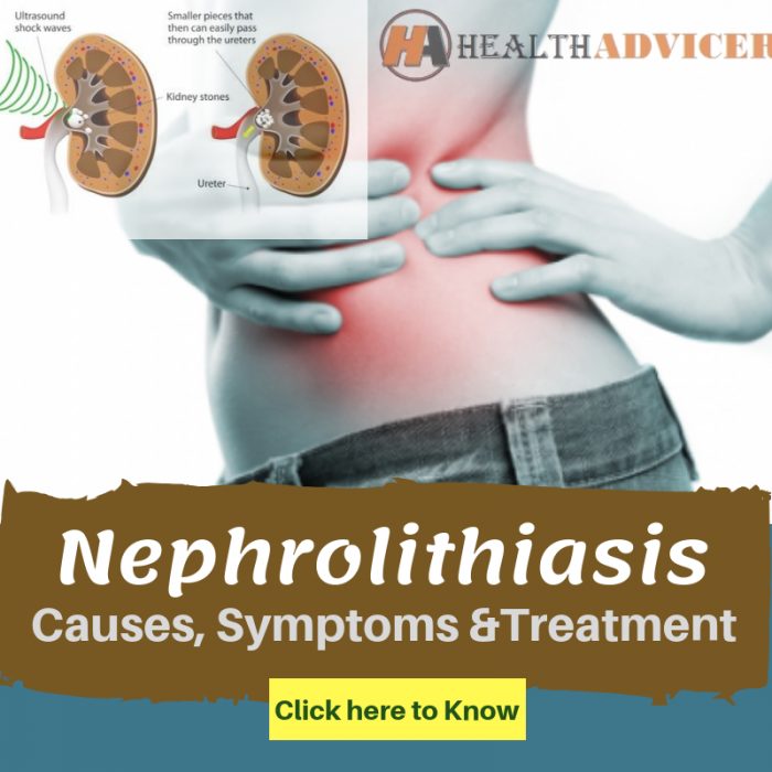 Nephrolithiasis