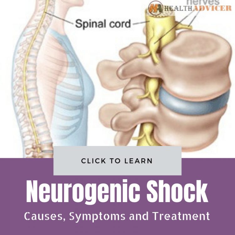 Neurogenic Shock Causes Treatment