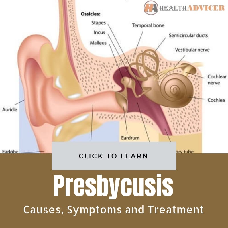 Presbycusis Causes Treatment