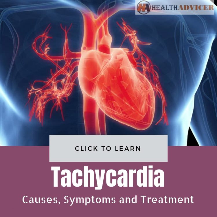 Tachycardia Causes Treatment