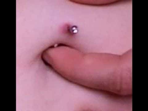 Infected Belly Button Piercing