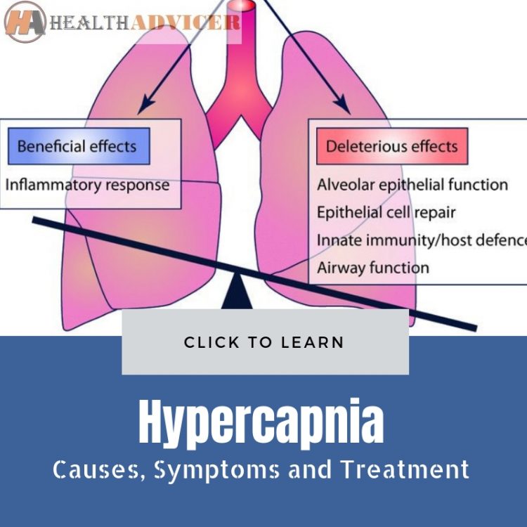 Hypercapnia