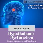 Hypothalamus Function Disorders