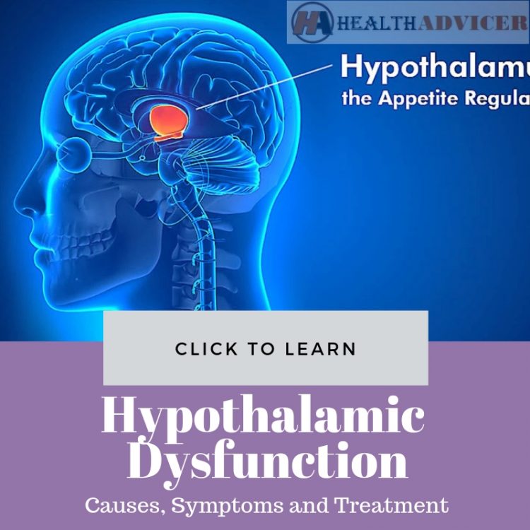 Hypothalamus Function Disorders