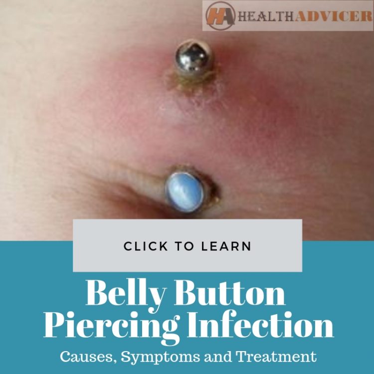 Infected Belly Button Piercing Picture