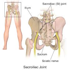 Sacroiliitis