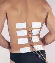 Electrical Stimulation