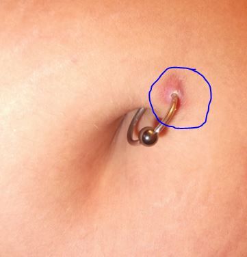 Signs Of Infected Belly Button Piercing
