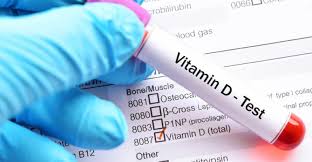 VITAMIN D DEFICIENCY DIAGNOSIS