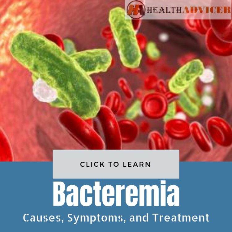 Bacteremia Causes Picture Treatment
