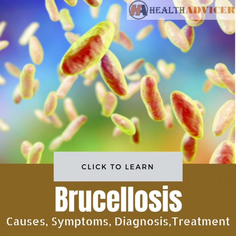 Brucellosis