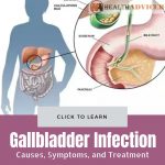 Gallbladder Infection Picture