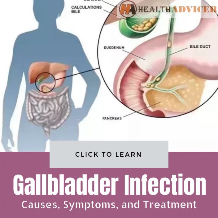 Gallbladder Infection Picture
