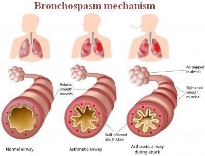 Bronchospasm