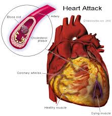 Blood Vessel Block