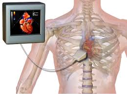 Echocardiogram