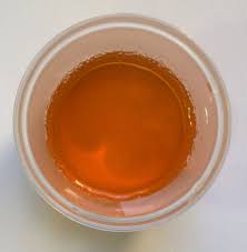 Dark Urine