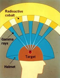 Stereotactic Radiosurgery