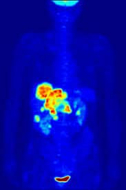 Radiological Tests