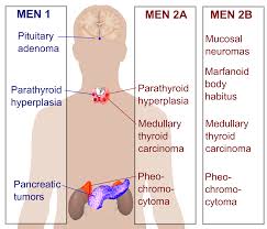 Multiple Endocrine Neoplasia Type 2