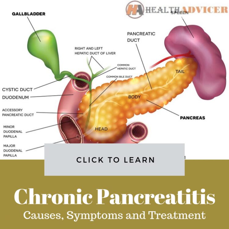 Chronic Pancreatitis