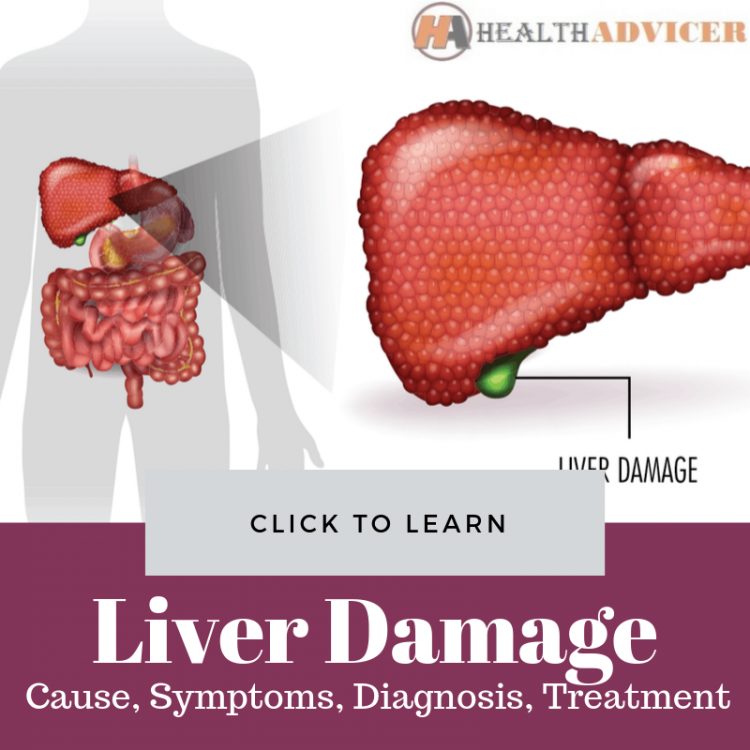 Signs Of Liver Damage