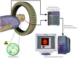 PET (Positron Emission Tomography) Scans