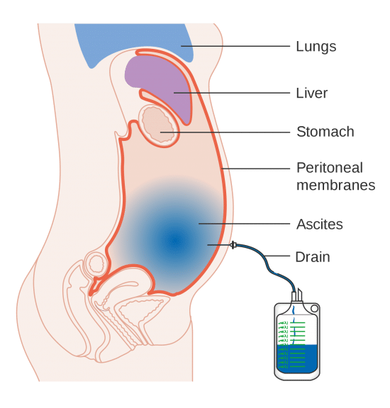 Fluid Sample Analysis