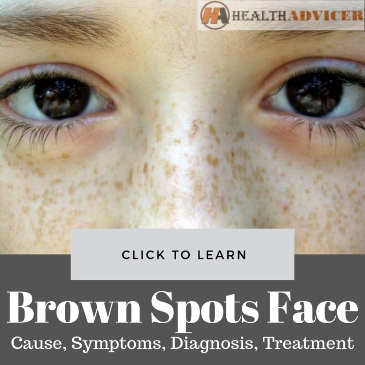 Brown Spots On Face
