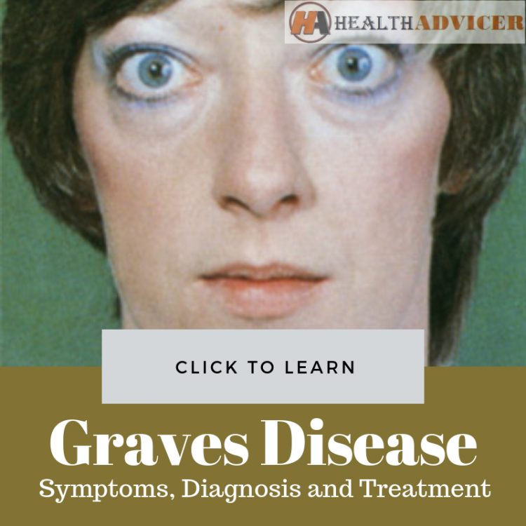 graves disease symptoms