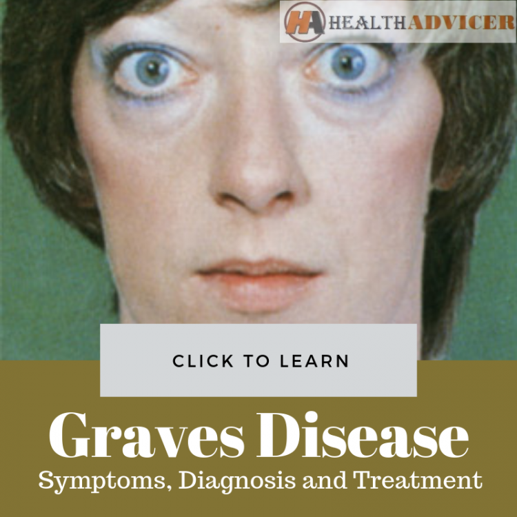 Graves Disease Picture