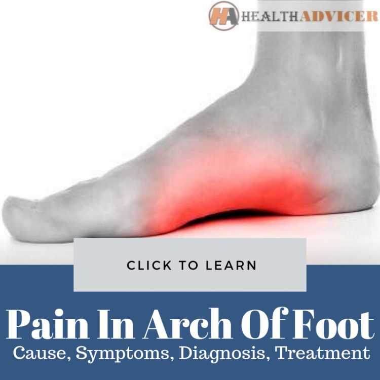 Pain In Arch Of Foot: Causes, Picture, Symptoms And Treatment